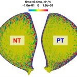Des simulations menées à l’IRFM confirment l’intérêt des plasmas à triangularité négative